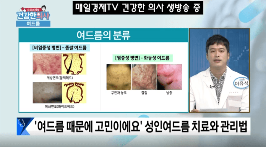 방송에서 못다 한 이야기, 평택 진료실에서 다시 짚은 여드름과 비만 관리